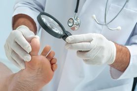 Grzybica stóp - rodzaje, przyczyny, objawy, diagnostyka, leczenie