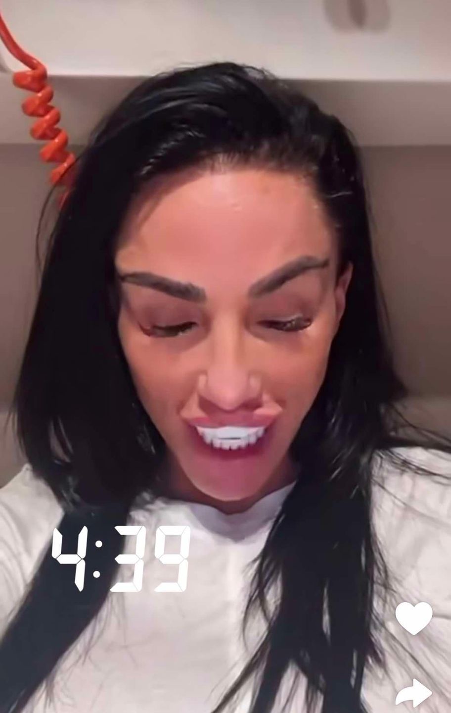 Katie Price prezentuje kulisy kolejnej operacji w Turcji