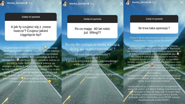 Blanka Lipińska ujawnia szczegóły ostatniego liftingu twarzy 