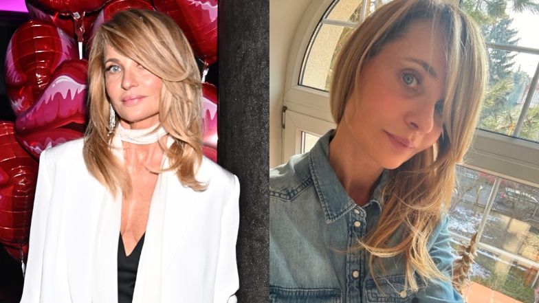 Aneta Kręglicka zdradza, jakie zabiegi medycyny estetycznej robi