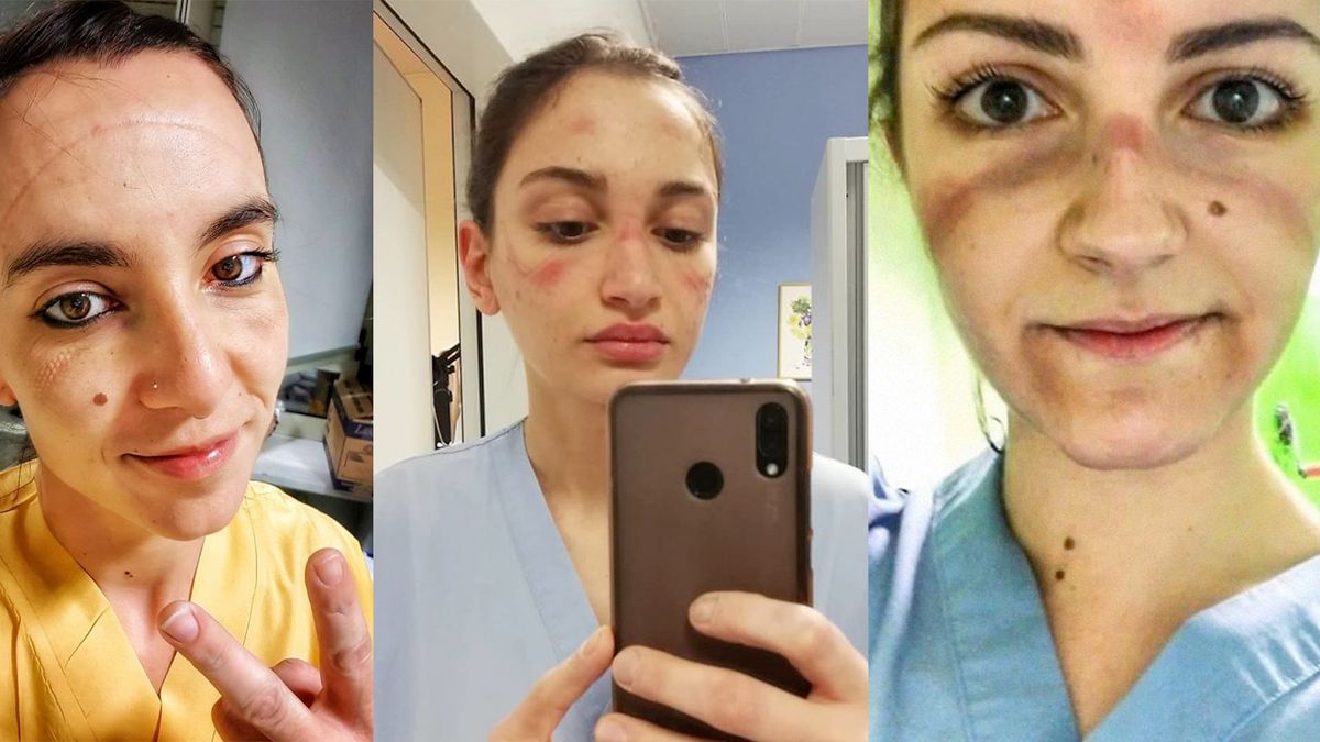 Lekarze i pielęgniarki po dyżurach. Te selfie pokazują twarze prawdziwych bohaterów 1