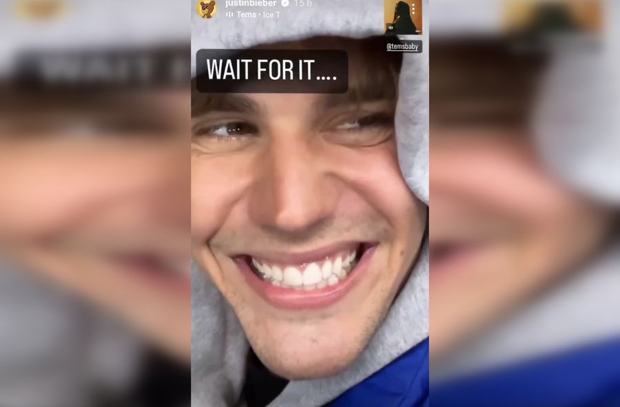 Justin Bieber odzyskał mobilność twarzy