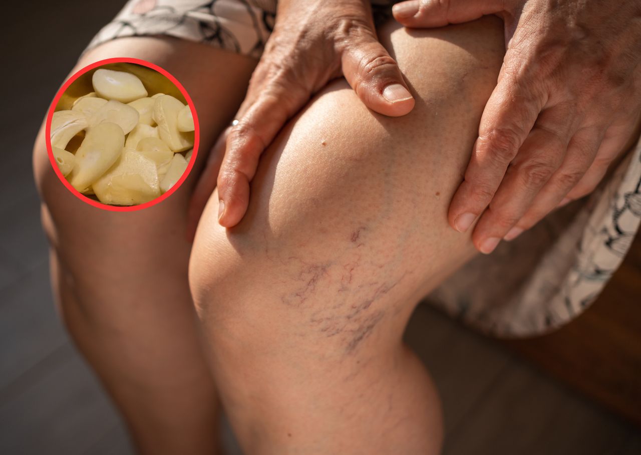 Rozrzedzają krew. Tania ochrona przed zakrzepicą i zatorem