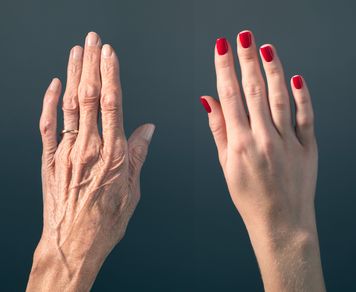 Tak sprawdzisz tempo starzenia. Kluczowe są dłonie