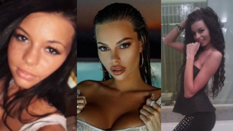 Justyna Gradek pokazała swoje zdjęcia sprzed operacji 