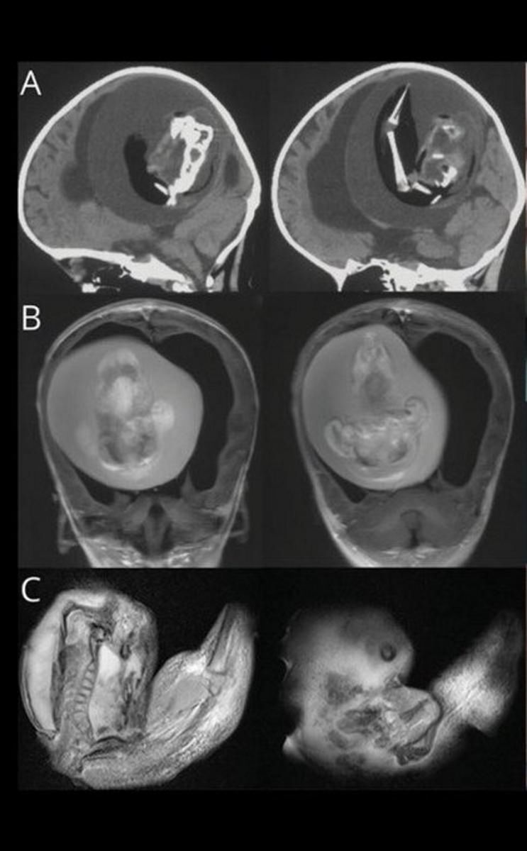Lekarze pokazali wyniki badania tomografem