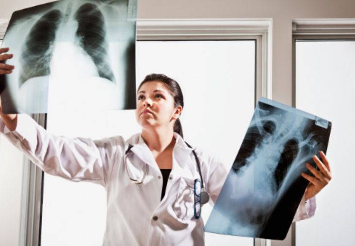 Mykobakterioza – objawy, rozpoznanie, leczenie