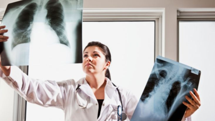 Liczne publikacje medyczne potwierdzają, że w ostatnich latach odnotowano wzrost liczby zachorowań na mykobakteriozę.