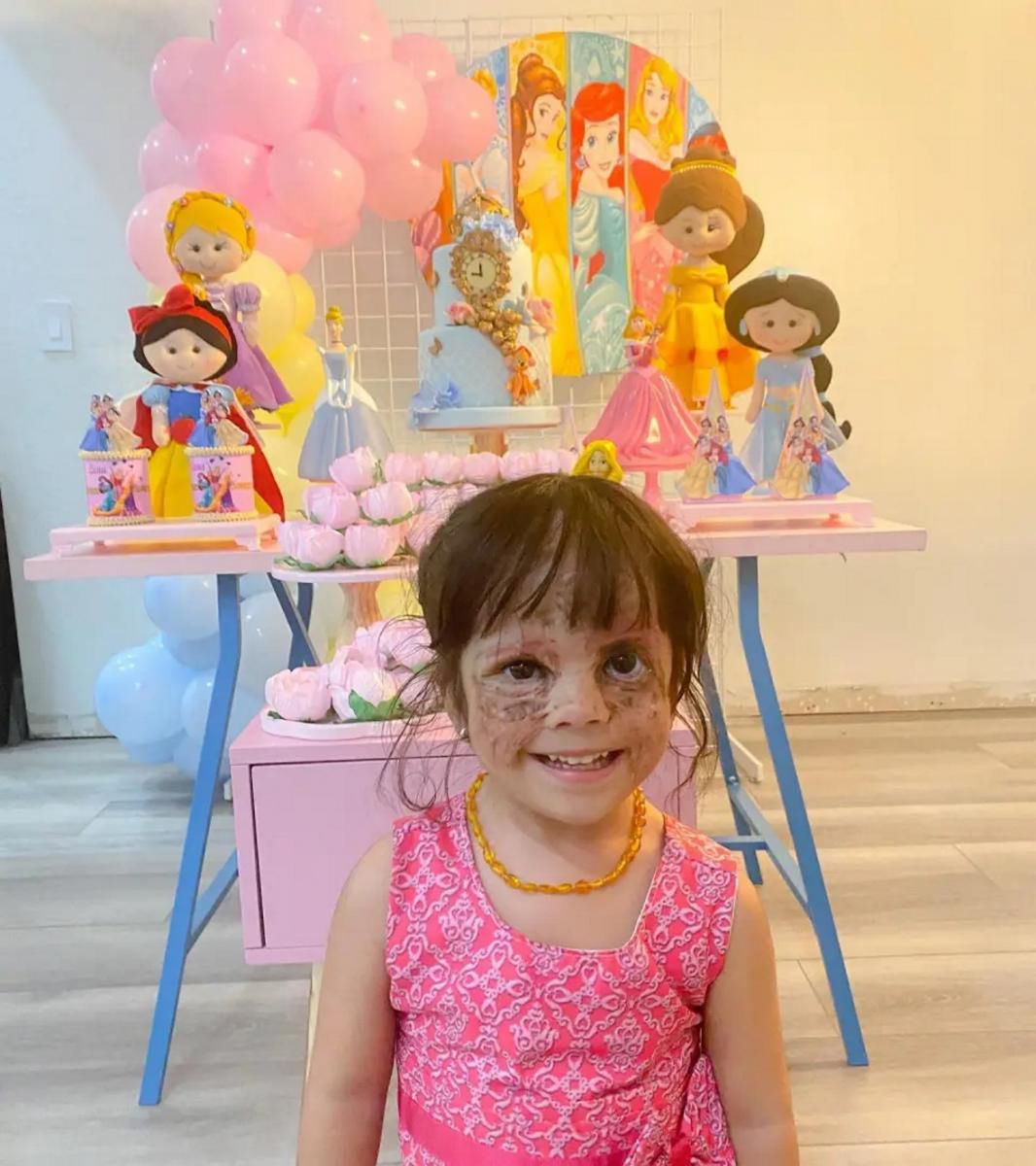 Przeszła pionierską operację, teraz walczy z powikłaniami