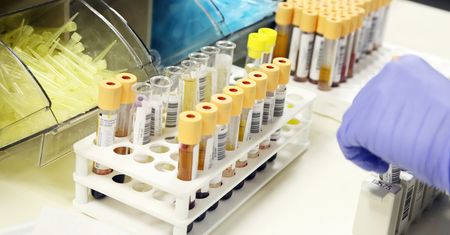 Azotyny w moczu – przyczyny, badanie moczu, infekcja dróg moczowych, ciąża