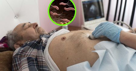 Jeden z czynników raka żołądka. "Rodzice w spadku przekazują nam bakterię"