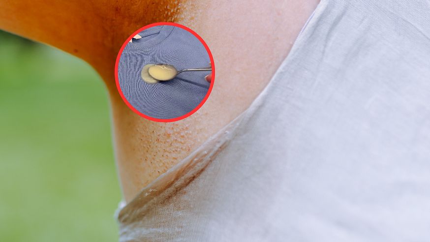 Domowe sposoby na plamy