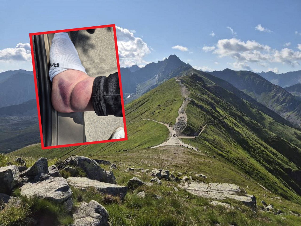 W trampkach poszedł w Tatry. "Jednak obuwie ma znaczenie"