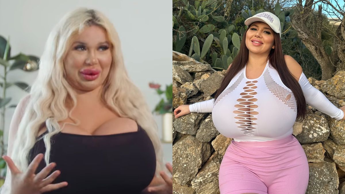 Wydała fortunę na operacje. Nie uwierzycie, jak wyglądała przed