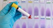 W Polsce żyje około 120 tys. osób nieświadomych zakażenia HCV