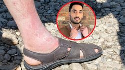 Upał zwiększa ryzyko zakrzepicy. Pij ten napój, by się ustrzec - lekarz poleca