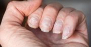 Tani patent. Wcieraj regularnie, a paznokcie "odżyją"