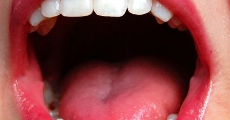 Egipcjanie u nas na wycieczce do... dentysty