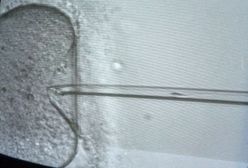 "Sprzedam komórkę jajową za 8 tys. zł"