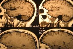 Dlaczego osoby z wysokim IQ nie odnoszą sukcesu?