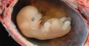 Naukowcy wzywają do modyfikowania ludzkich zarodków. Co stanie się z dziećmi?