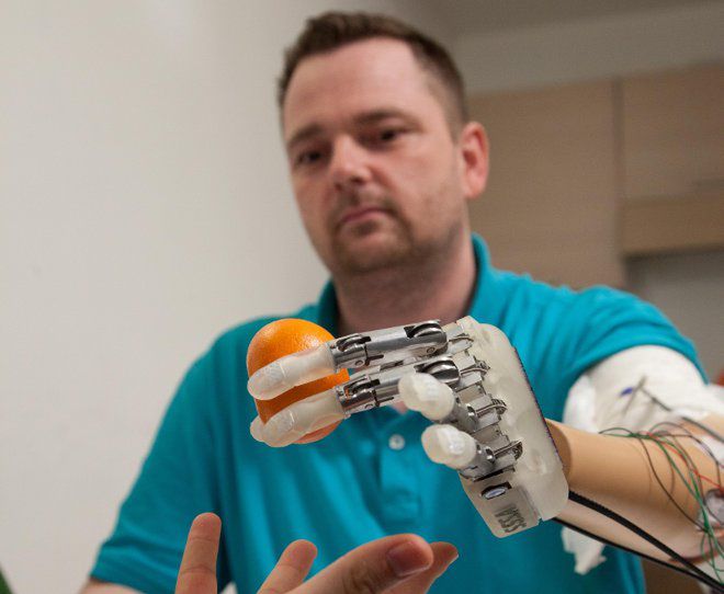 Po raz pierwszy wypróbowano bioniczną rękę, która czuje