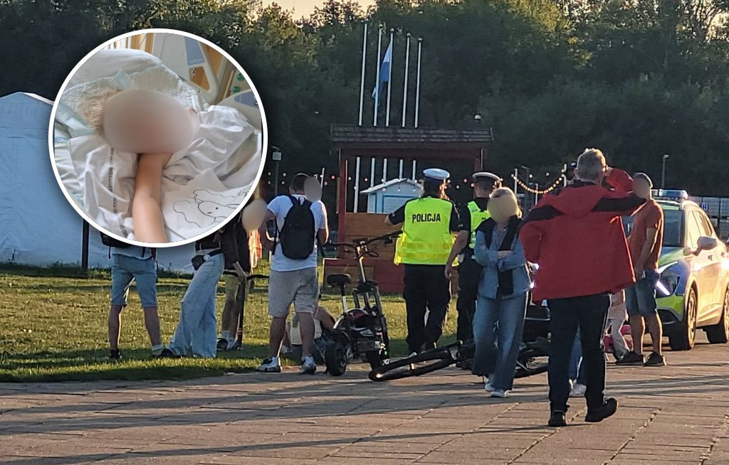 Nastolatek pędził na hulajnodze. Potrącił dziecko. "Odkryli podskórny wylew"