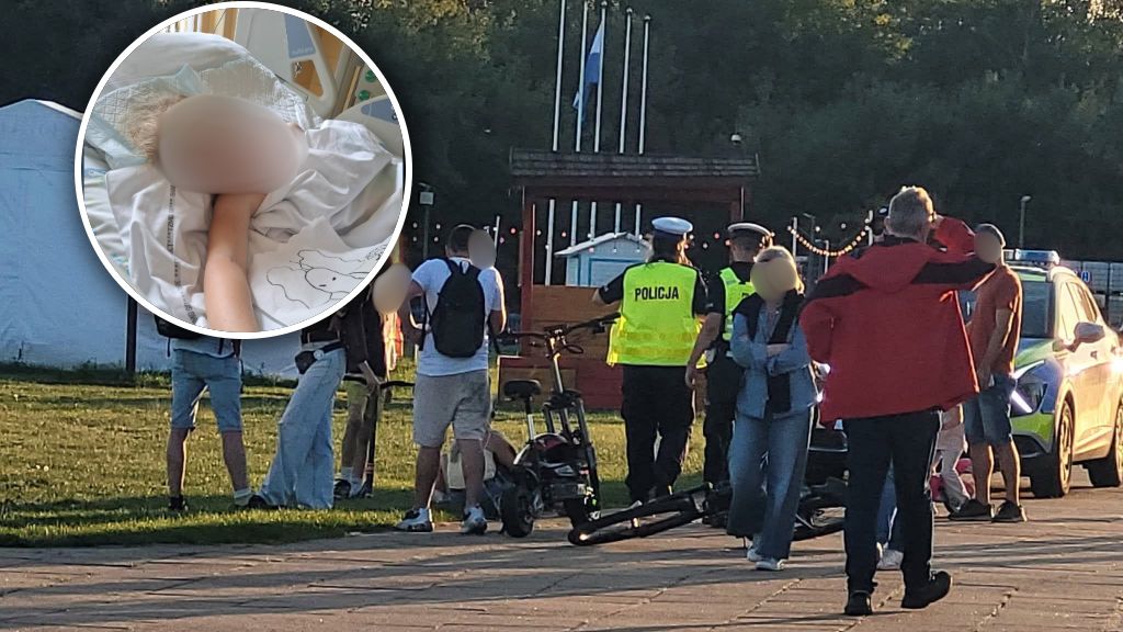 Amelka walczy o życie w szpitalu po wypadku na hulajnodze