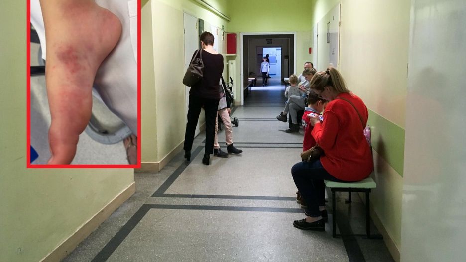 Widzisz te objawy u swojego dziecka? Biegnij do lekarza