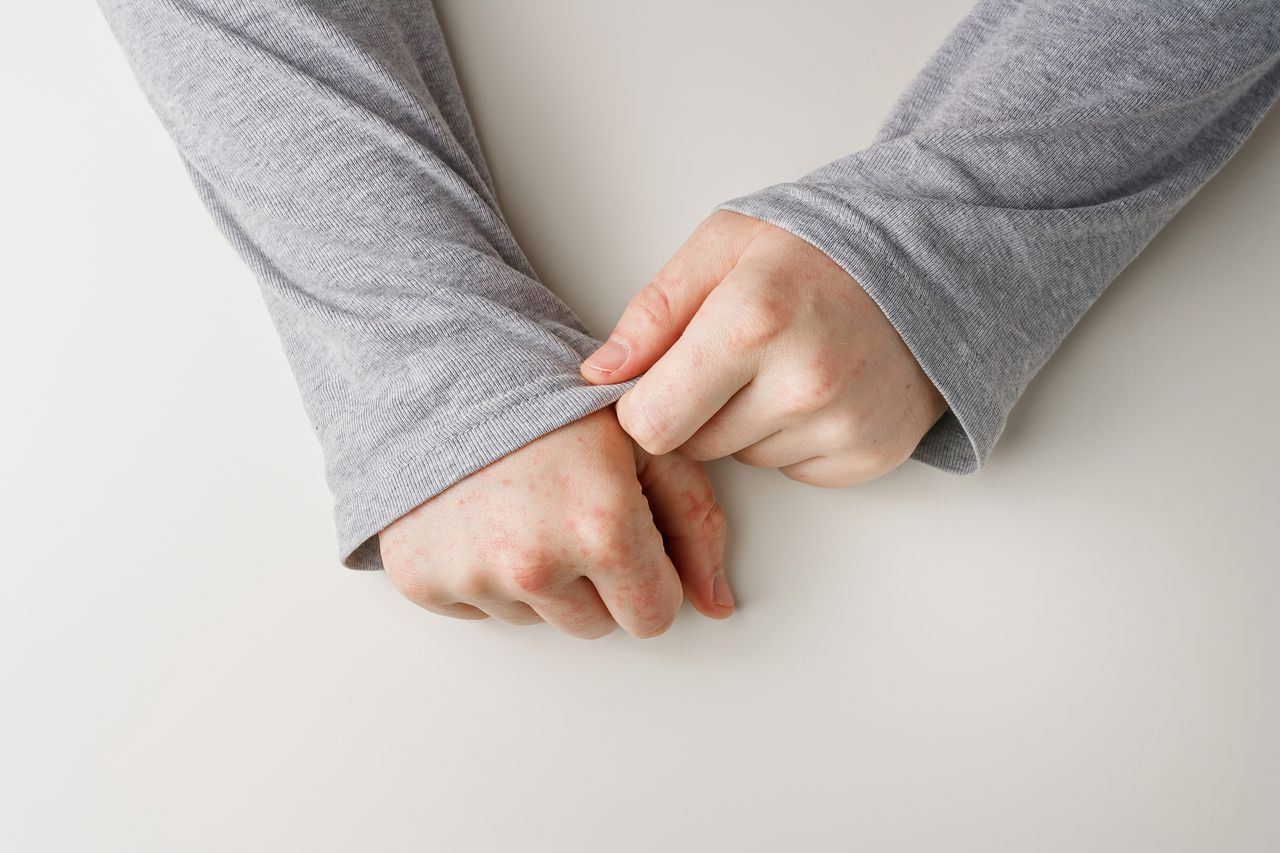 Alantolina i dekspantenol – odpowiedź na problemy psychodermatologiczne skóry