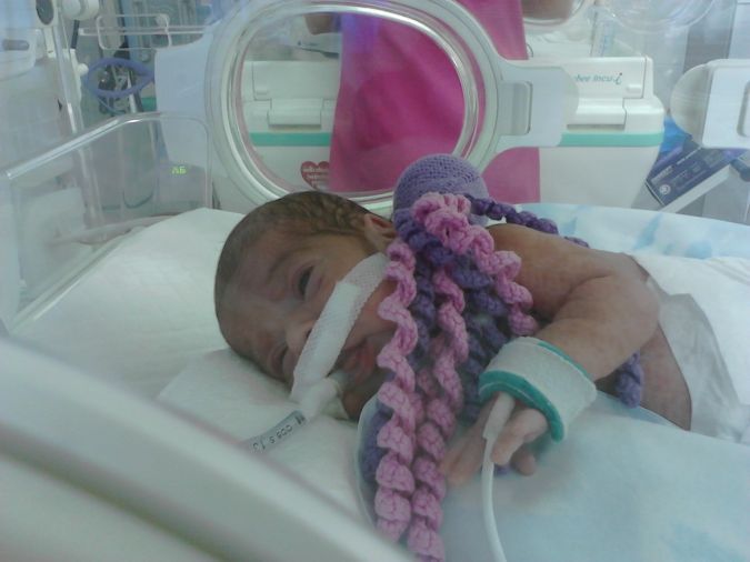 Kubuś przebywa w szpitalu od 3 miesięcy. / Archiwum prywatne