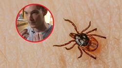 Cierpi na rzadkie zaburzenie po ukąszeniu kleszcza. "Czekam na śmierć"