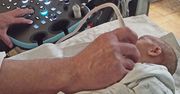 Legnica: Ten sprzęt ułatwi lekarzom diagnozowanie wcześniaków i noworodków