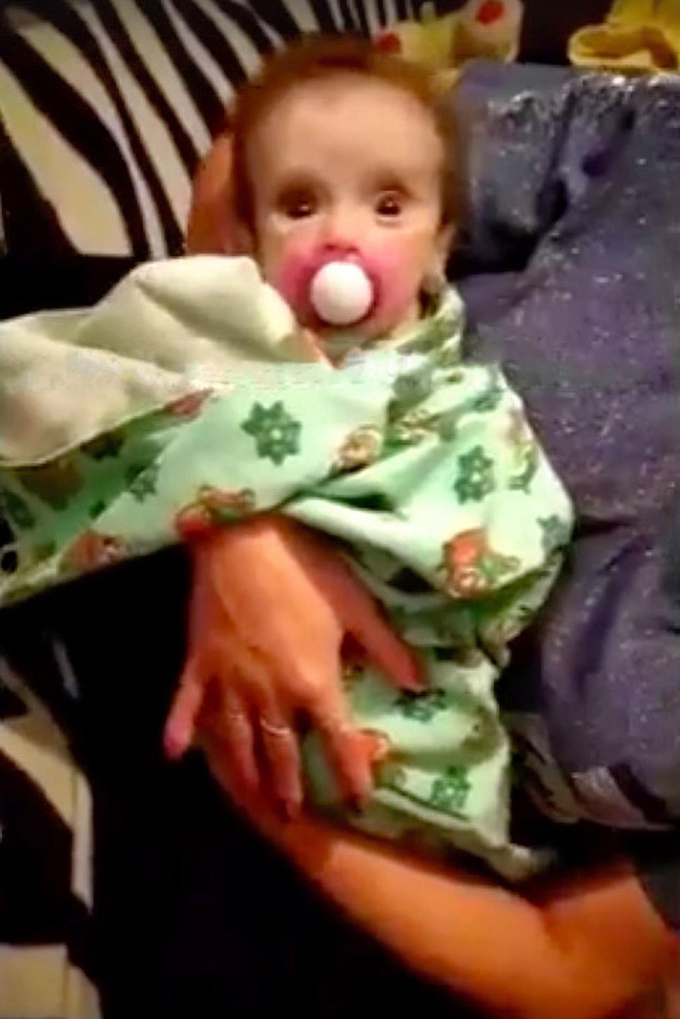 Dziewczynka niedługo po znalezieniu jej w szafie