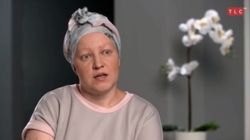 Łysiejące placki i wypadające brwi. Co dolega Marcie? (WIDEO)