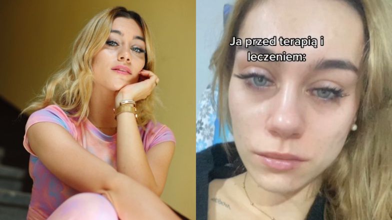 Ewa Zawada otwiera się na temat walki z NERWICĄ LĘKOWĄ