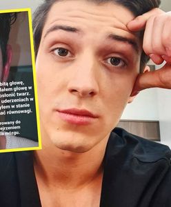 "Bili po twarzy, karku, brzuchu". Aktor pokazał swoje obrażenia