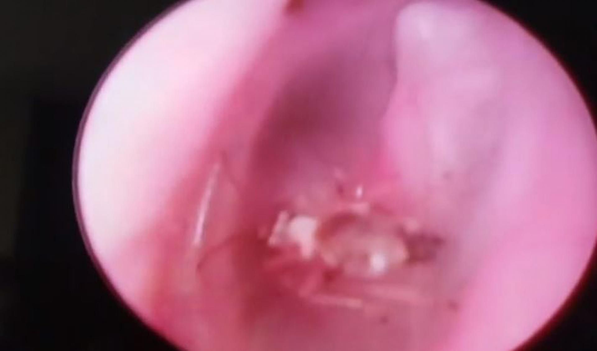 Widoczna mucha w uchu Recepa Korkmaza