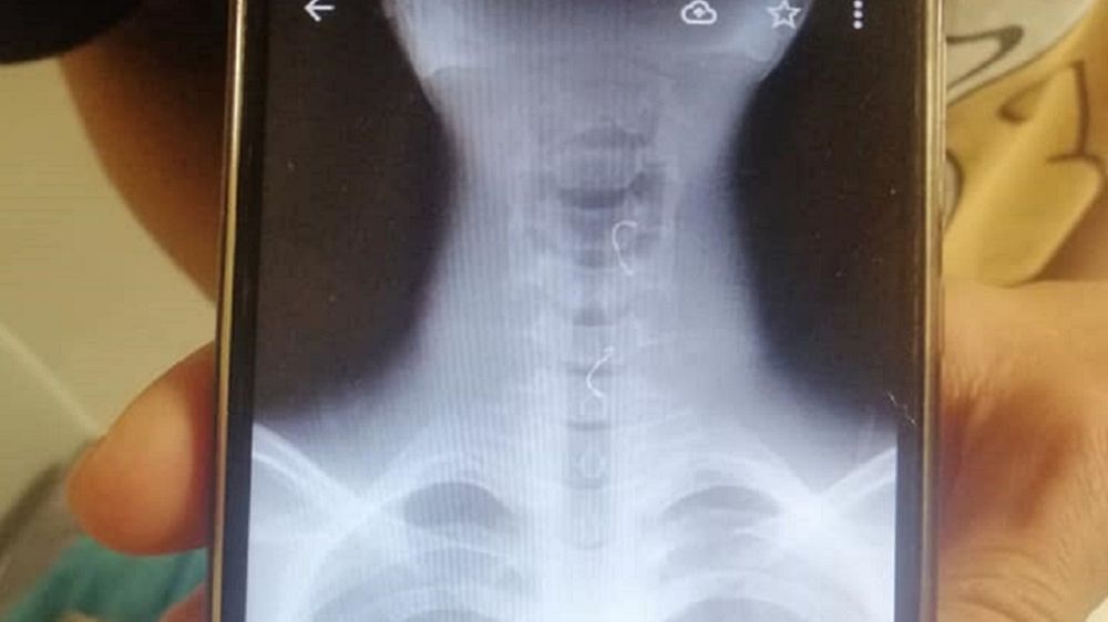 Nastolatek zadławił się przed sklepem w Czeladzi