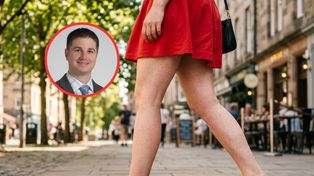 "Truskawkowe nogi" to zmora kobiet latem. Przyczyna jest jedna