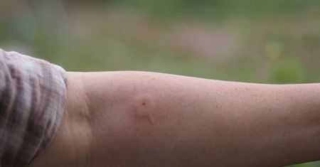 Teraz szczególnie uważaj. Ich użądlenie może być śmiertelne