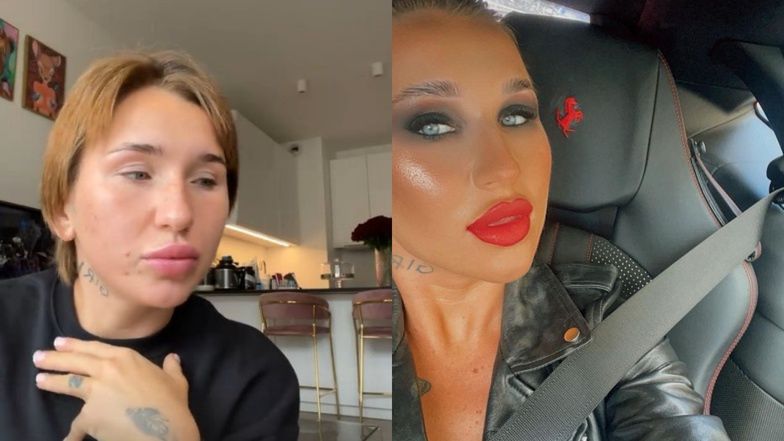 Marta Linkiewicz wraca do naturalnych ust