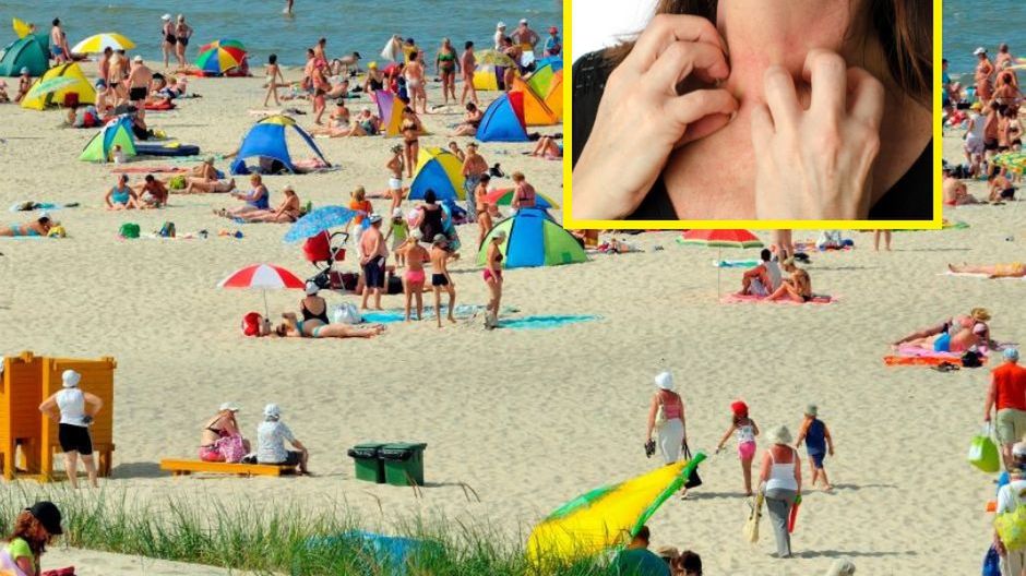 Prawdziwy wysyp pacjentów. Prosto z wakacji trafiają do lekarza