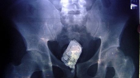 Mężczyzna schował telefon w tyłku, żeby uciec przed policją 1