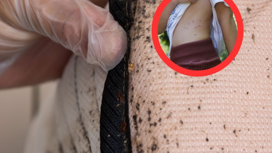 Ich obecność zauważysz na skórze po przebudzeniu. Pasożyty są szczególnie groźne dla dzieci