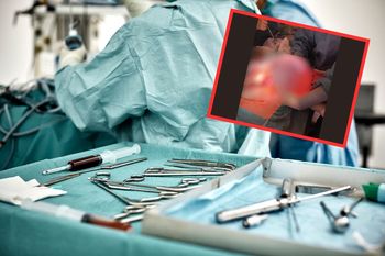 Pacjentka myślała, że przytyła. "Guz miał ponad 20 cm"