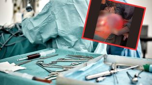 Pacjentka myślała, że przytyła. "Guz miał ponad 20 cm"