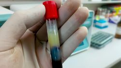 Jak zbić cholesterol bez leków? Wprowadź te zmiany już dziś