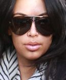Kardashian przesadziła z botoksem!