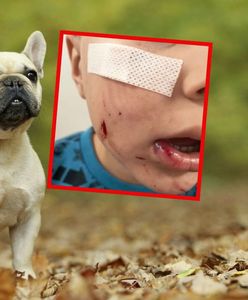 Brutalny atak psa na dziecko. Rodzice pilnie szukają właściciela